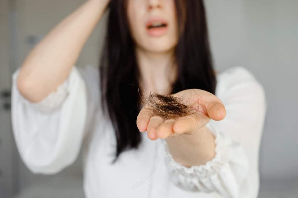 Women are prone to hair thinning, particularly after childbirth or during menopause, due to fluctuating hormone levels. 