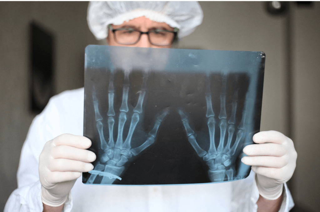 Lab investigations play an essential role in diagnosing and monitoring arthritis. X-rays or MRIs to monitor joint damage or cartilage deterioration.
