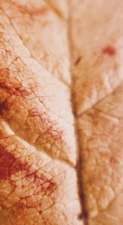 Dry, cracked skin will sometimes bleed and develop painful cracks if not cared for.
