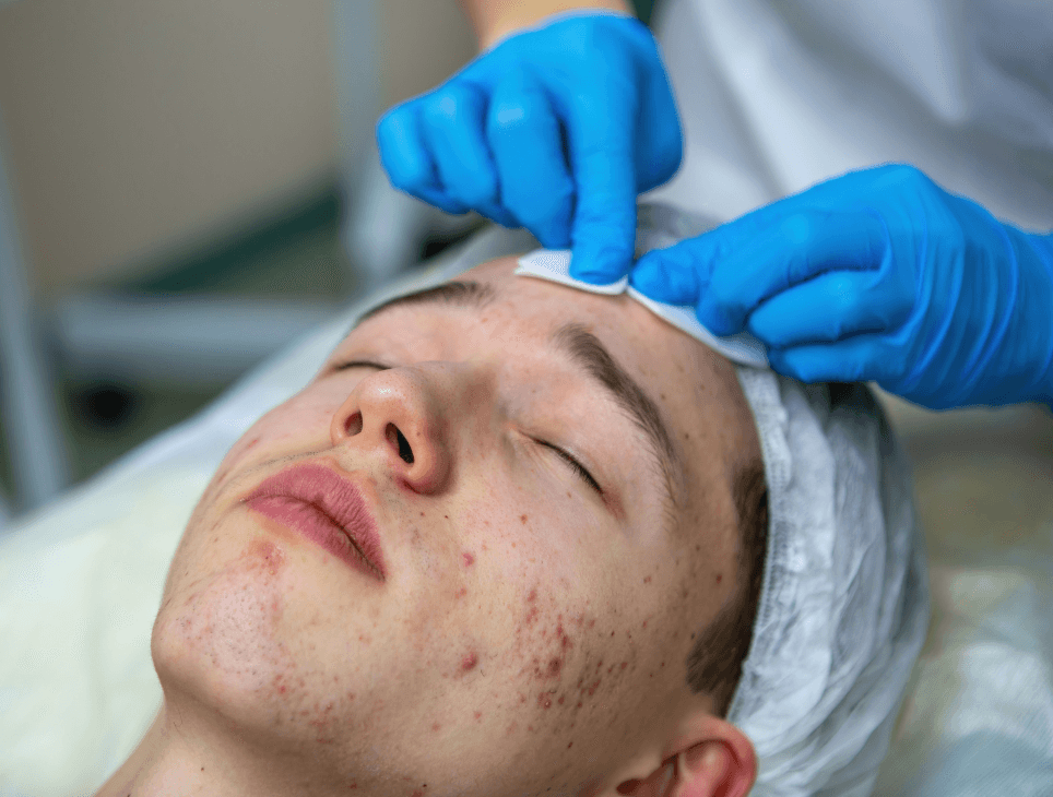 Avoid picking pimples: This reduces scarring and bacterial spread. 
